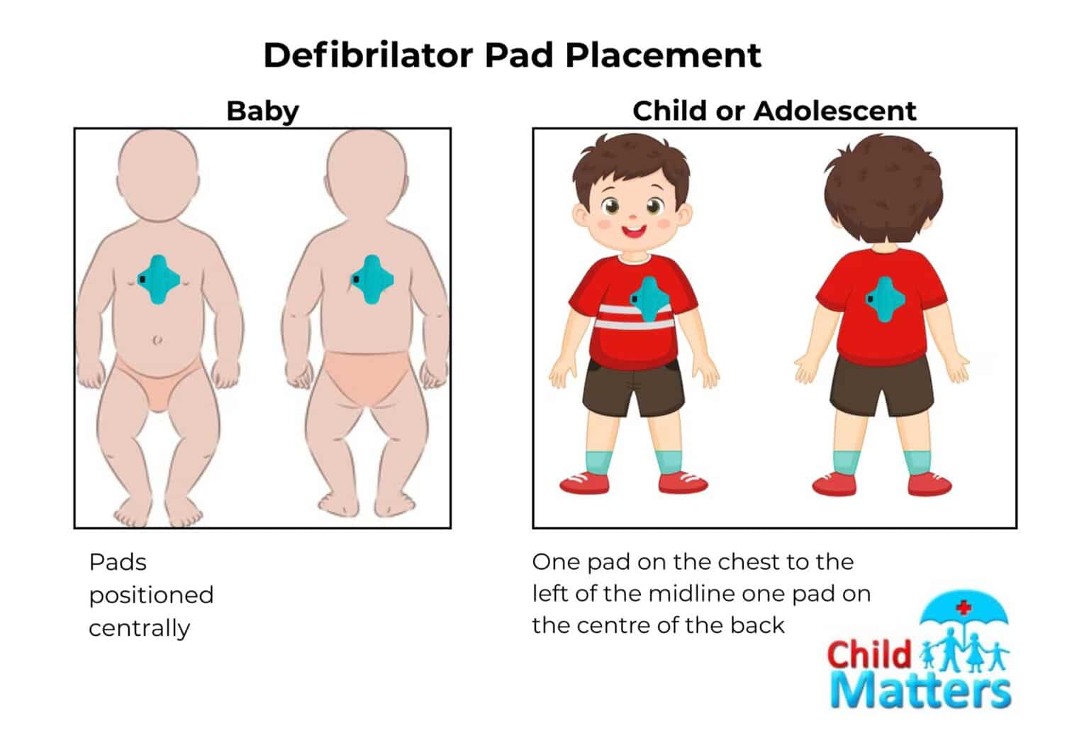 Paediatric Resuscitation Guideline Updates 2025 - Child Matters